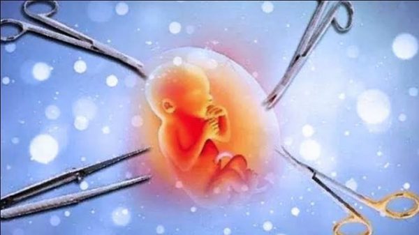 Polisi Akui Sulit Ungkap Aborsi Ilegal, Kabid Humas: Data Asli Pasien tidak Dimunculkan 38