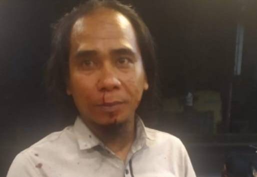 Aktivis Jadi Korban Kekerasan, Komnas HAM Surati Kapolda Sumut 9