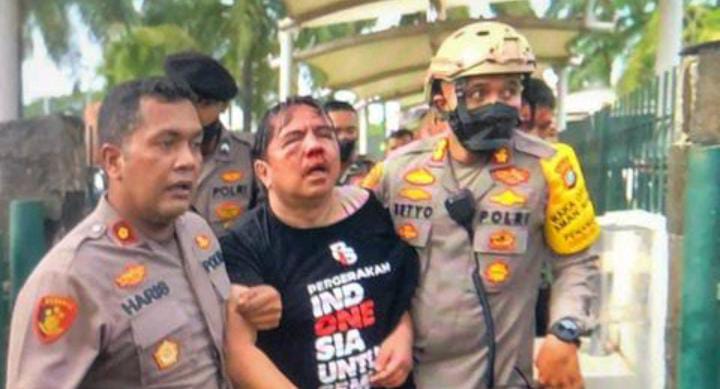 IPW Minta Polisi Usut Tuntas Pengeroyokan Ade Armando 51