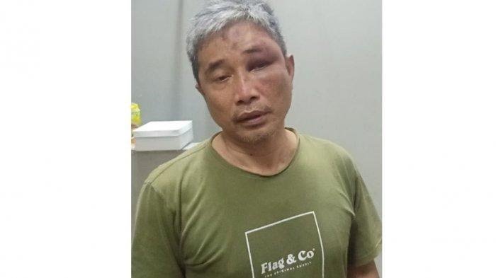 Tampang-Muhammad-Kece Bareskrim Polri Tetap Lanjutkan Penganiayaan Muhammad Kece 1