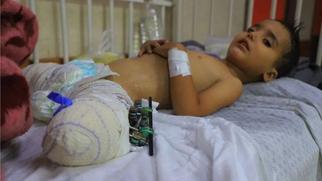 Intervensi Jerman Bela Israel Dikecam, Sesama Pelaku Genosida Saling Melindungi 54